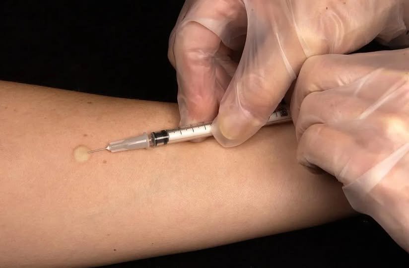 Φυματίωση: Τι πρέπει να ξέρουν οι γονείς (Tου Καστοριανού παιδίατρου Άκη Σωφρονίδη)
